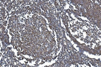 IHC staining of FFPE human tonsil with METTL3 antibody. HIER: boil tissue sections in pH8 EDTA for 2