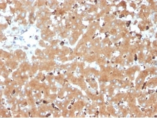 Haptoglobin Antibody