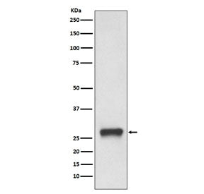 Western blot testing of human Daudi cell lysate with HLA-DPB1 antibody. Predicted molecular weight ~