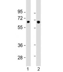 Western blot testing of human 1) SK-BR-3 and 2) TT cell lysate with SLC5A8 antibody at 1:1000. Predi