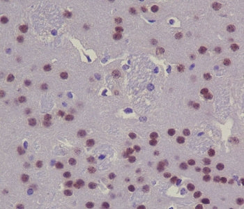 IHC staining of FFPE mouse brain with CREB1 antibody. HIER: boil tissue sections in pH6, 10mM citrat