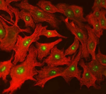 SUPT5H Antibody / SPT5