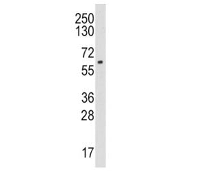 Western blot analysis of CYP19A1 / Aromatase antibody and HL-60 lysate. Predicted molecular weight ~