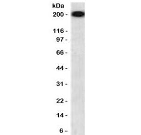 Western blot testing of human brain lysate with recombinant NF-H antibody (clone NFHP-1R). Expected 
