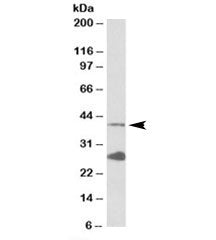 Western blot testing of K562 lysate with UROD antibody at 0.1ug/ml. The expected ~40kDa band and the