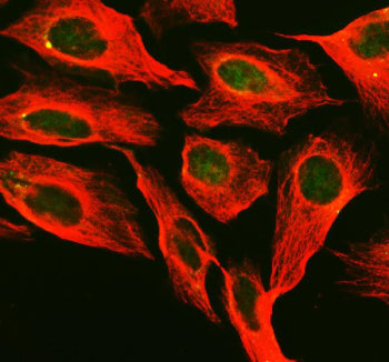 Immunofluorescent staining of PNKP using anti-PNKP antibody (green) and anti-Beta Tubulin antibody (