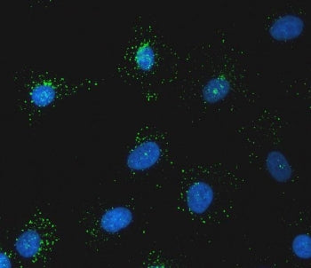 Sorting nexin 1 Antibody / SNX1