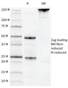 SDS-PAGE Analysis of Purified, BSA-Free CD22 Antibody (clone MYG13). Confirmation of Integrity and P