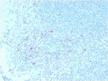 IHC testing of FFPE human tonsil tissue with CD25 antibody (clone IL2RA/2395). HIER: boil tissue sec