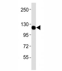 CSF1R Antibody