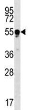 TUBB4Q Antibody (Tubulin beta 4Q)