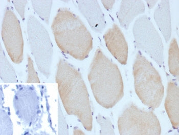 IHC staining of FFPE human skeletal muscle tissue with recombinant Myosin 7 antibody (clone MYH7/130