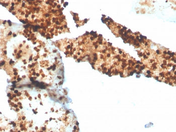 S100P Antibody