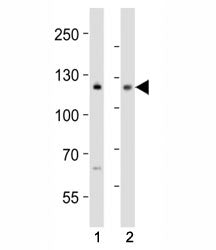 NOTCH1 Antibody