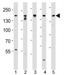 Western blot analysis of lysate from SH-SY5Y, MCF-7, PC3, LNCaP, HeLa, cell line (left to right) usi