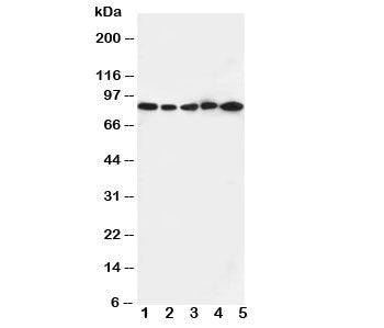 Western blot testing of CD18 antibody and Lane 1: Jurkat cell lysate ; 2: CEM; 3: HT1080; 4: SMMC-77