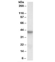 Western blot testing of HepG2 lysate with PINX1 antibody at 0.3ug/ml. Predicted molecular weight: ~3