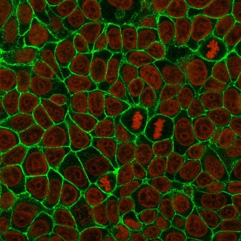 Immunofluorescent staining of human MCF7 cells with E-Cadherin antibody (green, clone 4A2) and Reddo