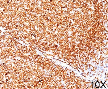 IHC testing of FFPE human tonsil stained with CD79a antibody (clone JCB117). Required HIER: boil tis
