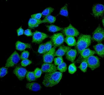 Immunofluorescent staining of FFPE human A431 cells with NMI antibody (green) and DAPI nuclear stain