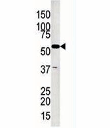 Glycerol kinase 2 antibody used in western blot to detect GK2 in Jurkat lysate