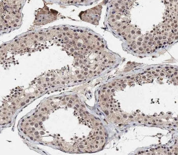 IHC testing of FFPE human testis tissue with BRD9 antibody. HIER: steam section in pH9 EDTA for 20 m