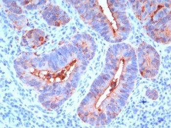CEA Antibody / Carcinoembryonic Antigen
