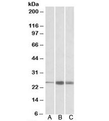 Western blot testing of human [A], mouse [B] and rat [C] skeletal muscle lysate with TNNI2 antibody 