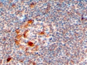 IHC testing of FFPE human lymph node with ZCCHC11 antibody at 4ug/ml. HIER: steamed with pH6 citrate