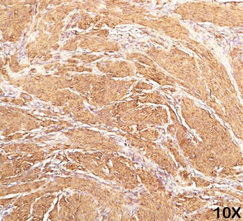 Actin Antibody (pan muscle)