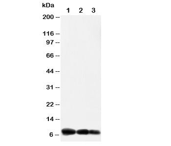 Western blot testing of IP10 antibody and Lane 1: recombinant human protein 10ng; 2: 5ng; 3: 2.5ng