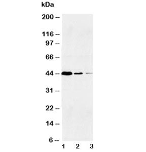 Western blot testing of human 1) Jurkat, 2) Raji and 3) CEM lysate with Caspase-1 antibody at 0.5ug/