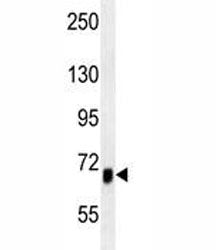 ACVR1B Antibody / Activin receptor type-1B / ALK4, 0.4ml