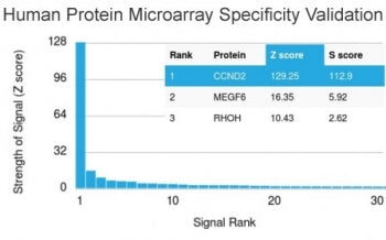 Analysis of HuProt(TM) microarray containing more than 19,000 full-length human proteins using Cycli