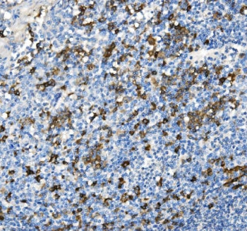 IHC staining of FFPE human tonsil with CD38 antibody. HIER: boil tissue sections in pH8 EDTA for 20 