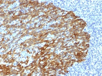 IHC staining of FFPE human tonsil with Basic Cytokeratin antibody (clone DE-SQ). HIER: boil tissue s