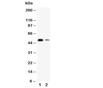 Western blot testing of KLF8 antibody and Lane 1: SMMC-7721; 2: 293T cell lysate. Predicted size ~40