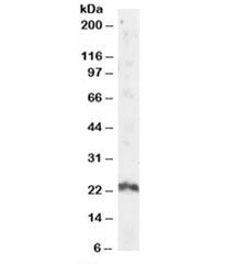 Western blot testing of human testis lysate with ARL4A antibody at 2ug/ml. Predicted/observed molecu