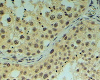 IHC testing of FFPE human testis with REV1 antibody at 4ug/ml. HIER: steamed with pH9 Tris/EDTA buff