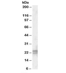 Western blot testing of human lung lysate with ARL6 antibody at 0.5ug/ml. Predicted molecular weight