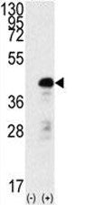 Western blot analysis of SOX2 antibody and 293 cell lysate (2 ug/lane) either nontransfected (Lane 1