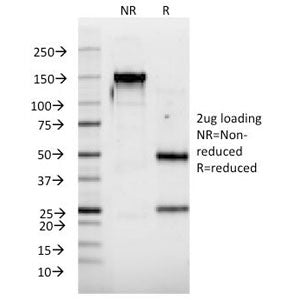 SDS-PAGE Analysis of Purified, BSA-Free Interferon alpha 2 Antibody (clone N39). Confirmation of Int