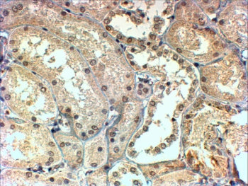 TBLR1 Antibody