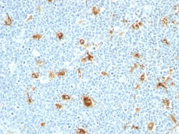 IHC: Formalin-fixed, paraffin-embedded human tonsil stained with Calgranulin A + B antibody (CAGB/42