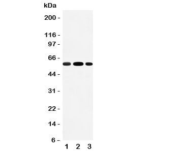 Western blot testing of EAAT3 antibody and Lane 1: rat liver; 2: rat heart; 3: mouse HEPA cell lysat