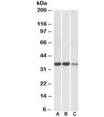 Western blot testing of heart [A], skeletal muscle [B] and kidney [C] lysates with LDHA antibody at 