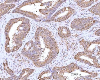 RPN1 Antibody / Ribophorin 1