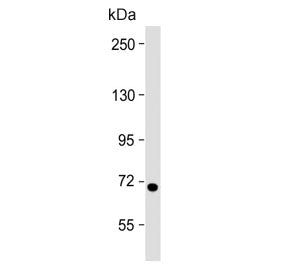 Western blot testing of human Jurkat cell lysate with HBS1L antibody. Predicted molecular weight ~75