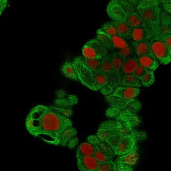 Immunofluorescent staining of MeOH fixed human MCF7 cells with Keratin 19 antibody (clone BA17, gree