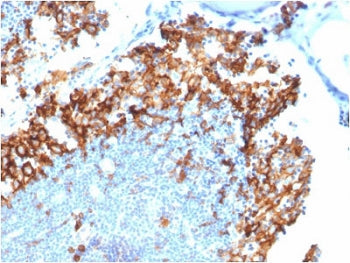 IHC staining of FFPE human lymph node with CD123 antibody. HIER: boil tissue sections in 10mM Tris w